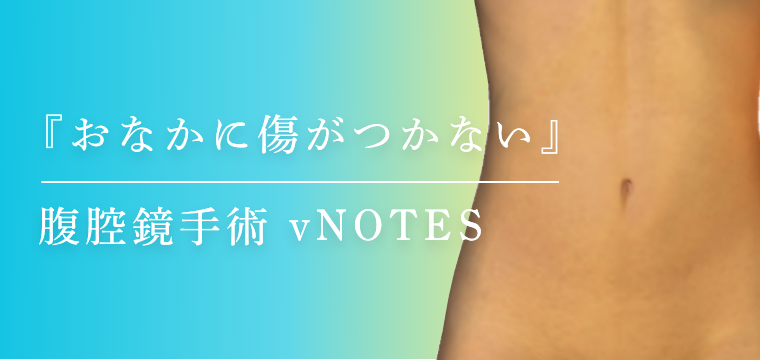 『おなかに傷がつかない』腹腔鏡手術 vNOTES